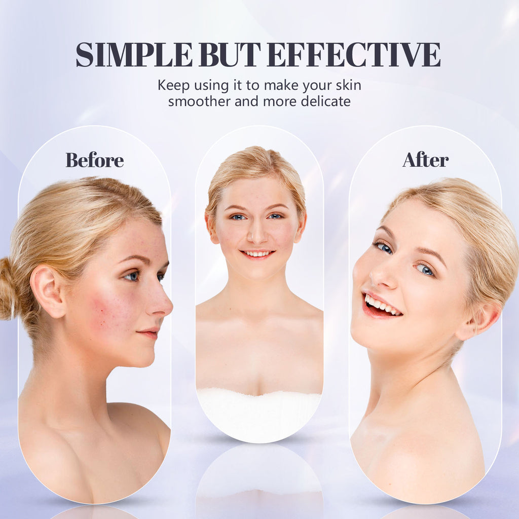 Livynest Red Light Therapy Mask for Face, LED Face Mask Light Therapy for Wrinkles & Acne, Wireless 4 Modes, Anti Aging Device for Smoother, Clearer Skin with 660nm 850nm Infrared